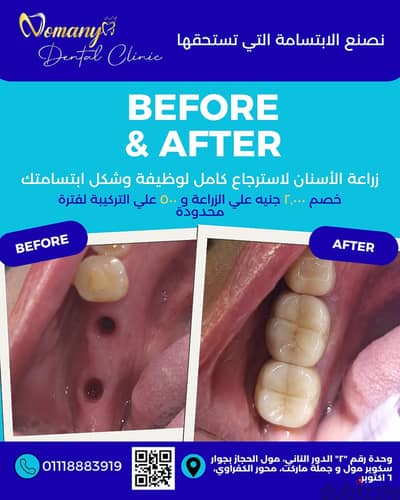 Dental Offers in 6 october
