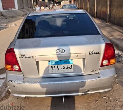 هيونداي فيرنا 2017