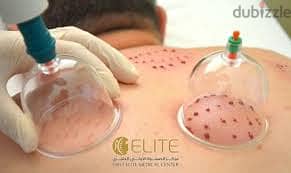 جلسات منزليه حجامه وعلاج طبيعي
