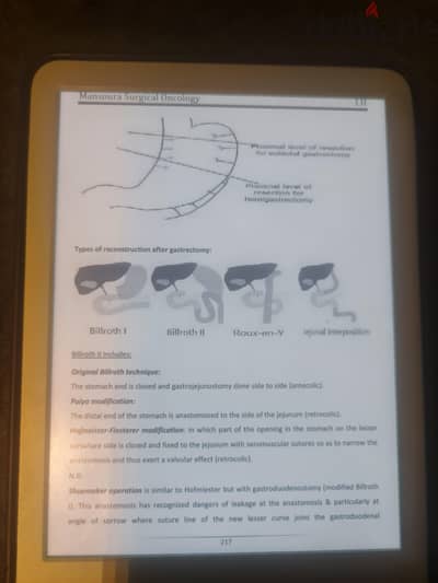 كاندل الجيل ١ا . . kindle amazon