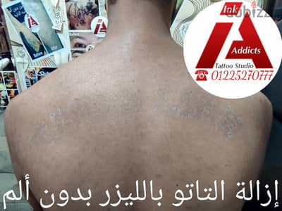 إزالة التاتو و المايكروبلدينج بالليزر بدون ألم
