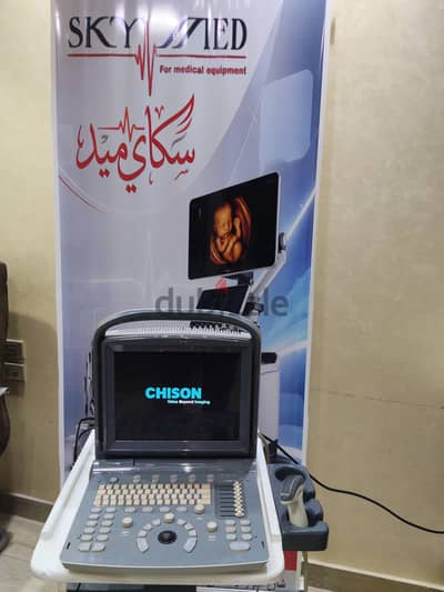 سونار شيزون   chison eco 1expert