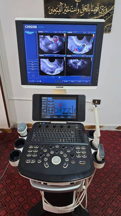 Ultrasound chison