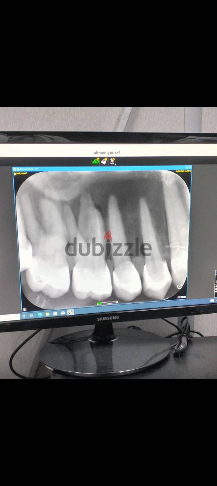 CSD Imaging plate size 2 1