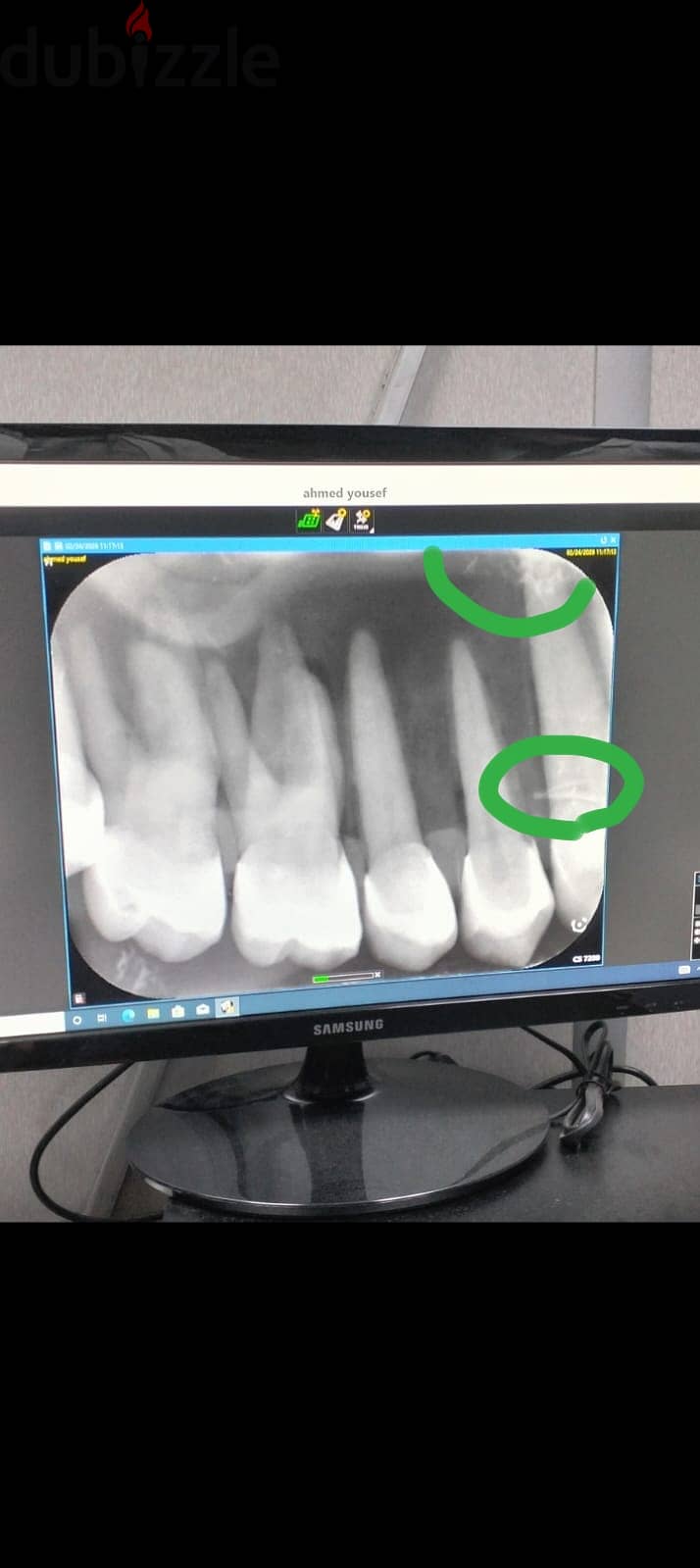 CSD Imaging plate size 2 2