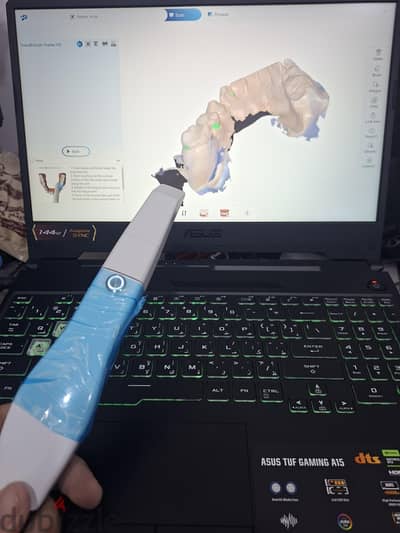 لاب asus a15 لاطباء وفنيين الاسنان(intraoral scaner)