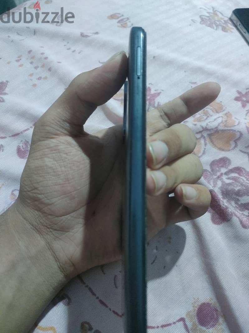 Xiaomi Redmi Note 11 1
