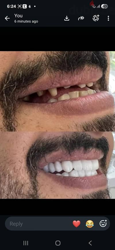 المركز الالمانى لعلاج المسنين وذات الحاجه فى منازلهم اوالمراكزالطبيه