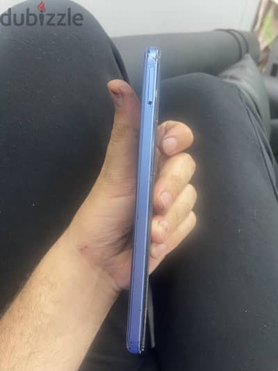 Honor 6X