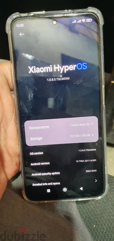 Xiaomi Redmi Note 11