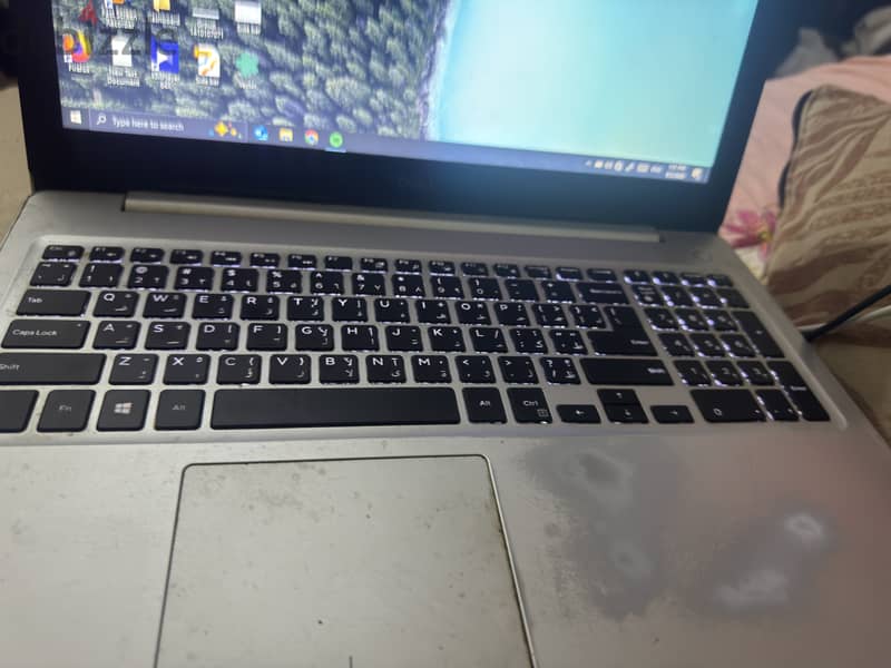 Dell inspiron 5570 1