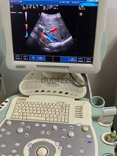 Esaote MyLab 50 XVision