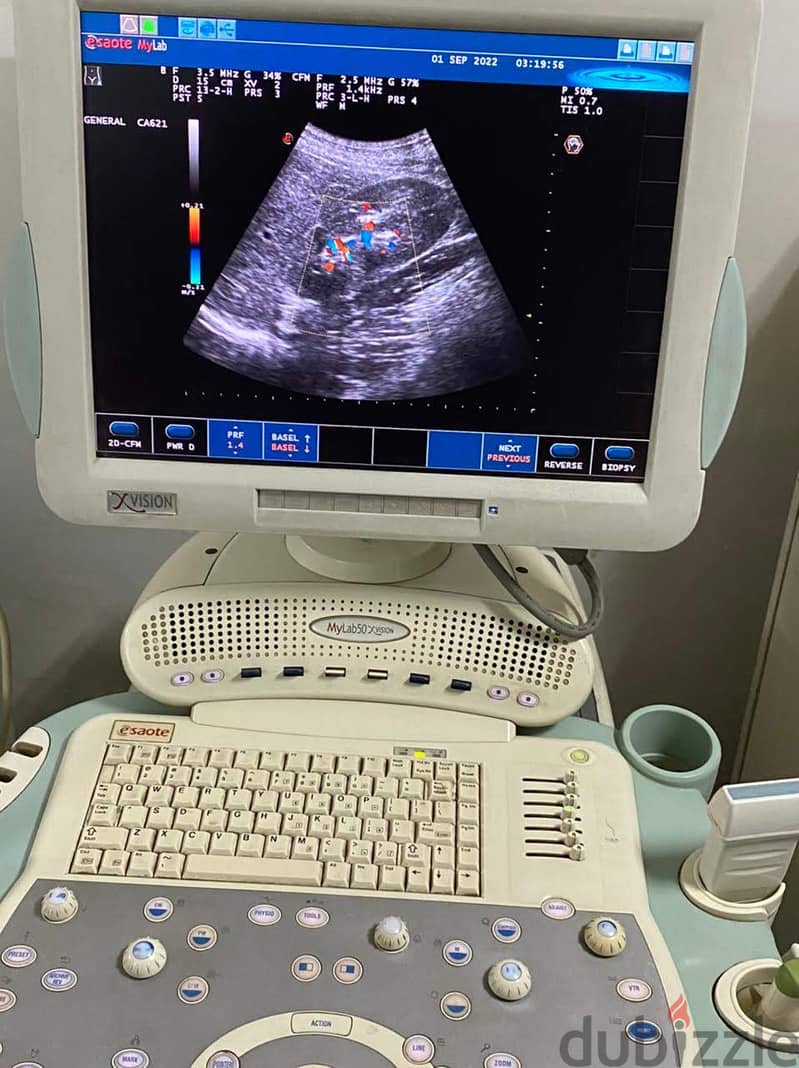 Esaote MyLab 50 XVision 2