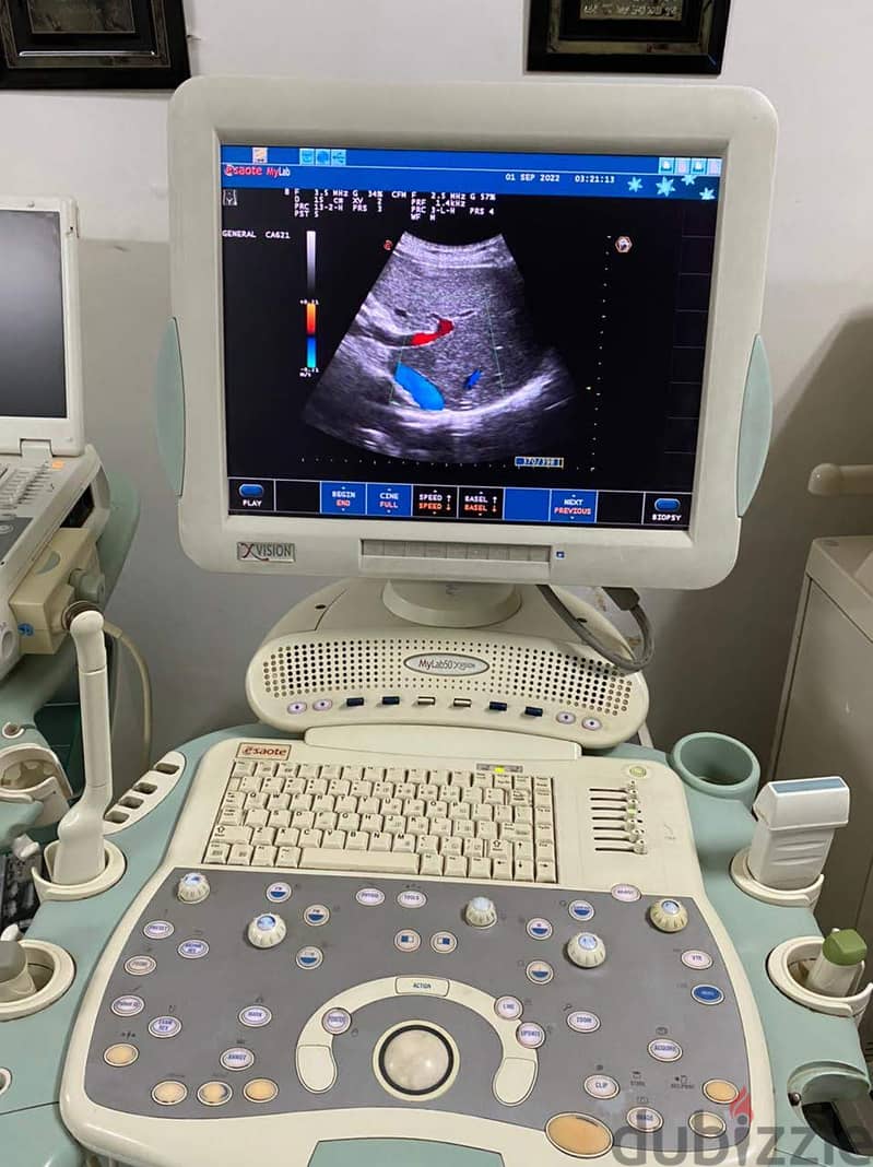 Esaote MyLab 50 XVision 3