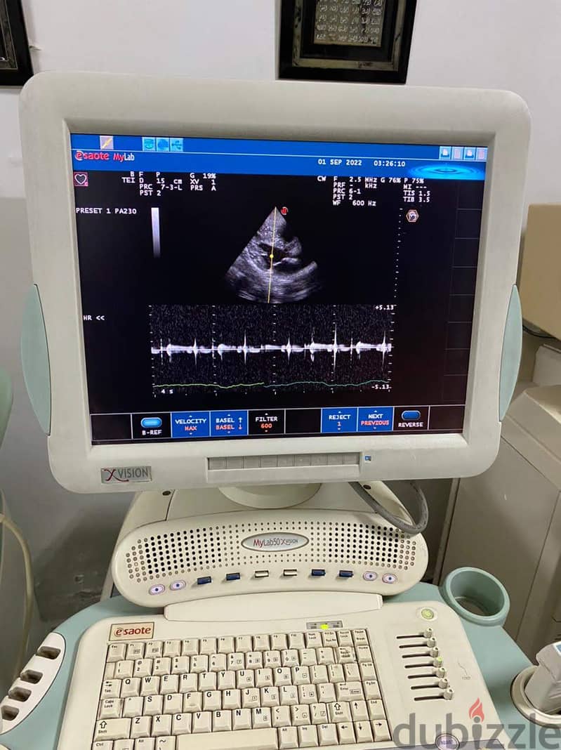 Esaote MyLab 50 XVision 4