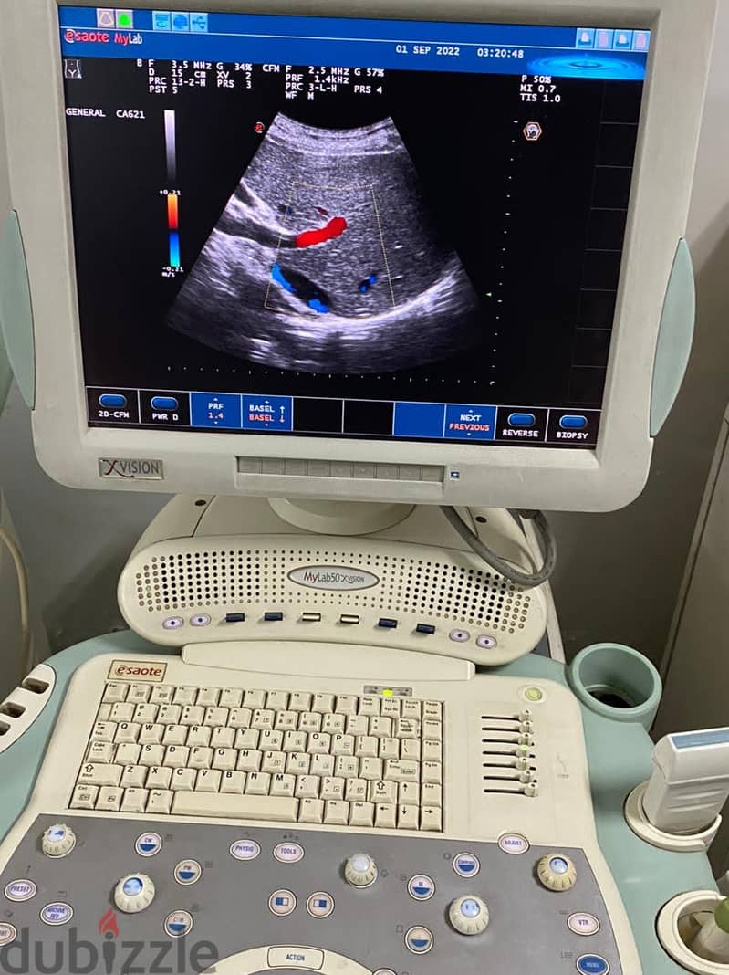 Esaote MyLab 50 XVision 5