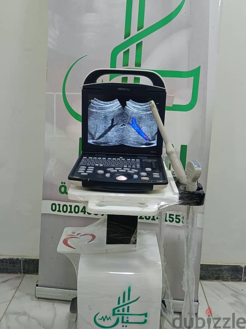 Mindray Dp20 3