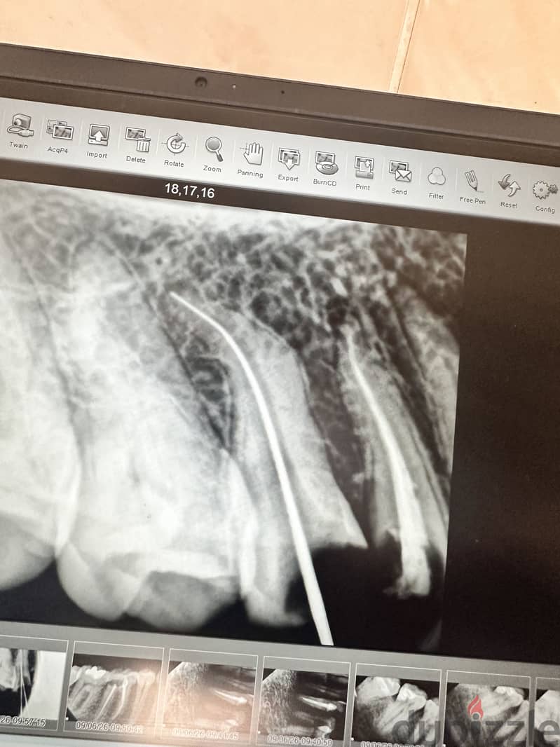 Dental Xray rundeer 2