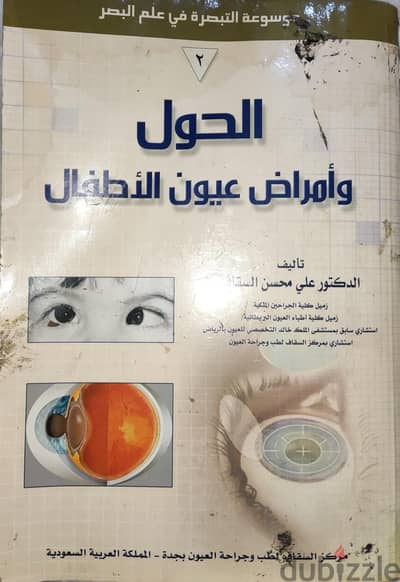 الحول وامراض عيون الاطفال