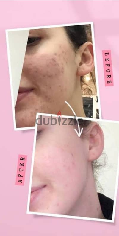 تنظيف بشرة
