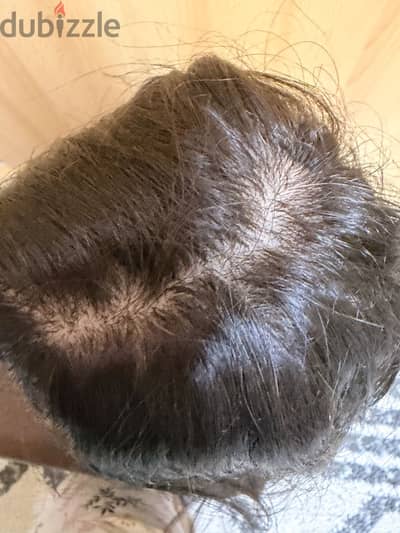 Hair wig