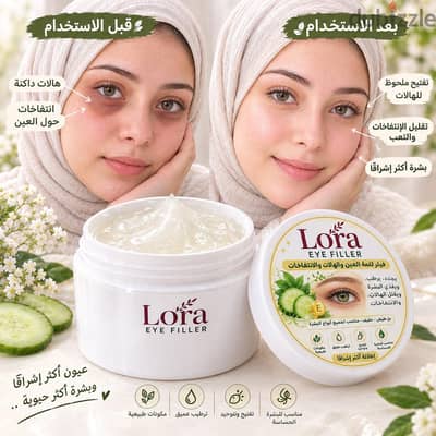 فيلر علاج الهالات وانتفاخ حولين العيون