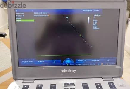 جهاز ايكو سونار مندراي  mindray echo M9