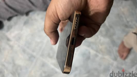 Honor X9b