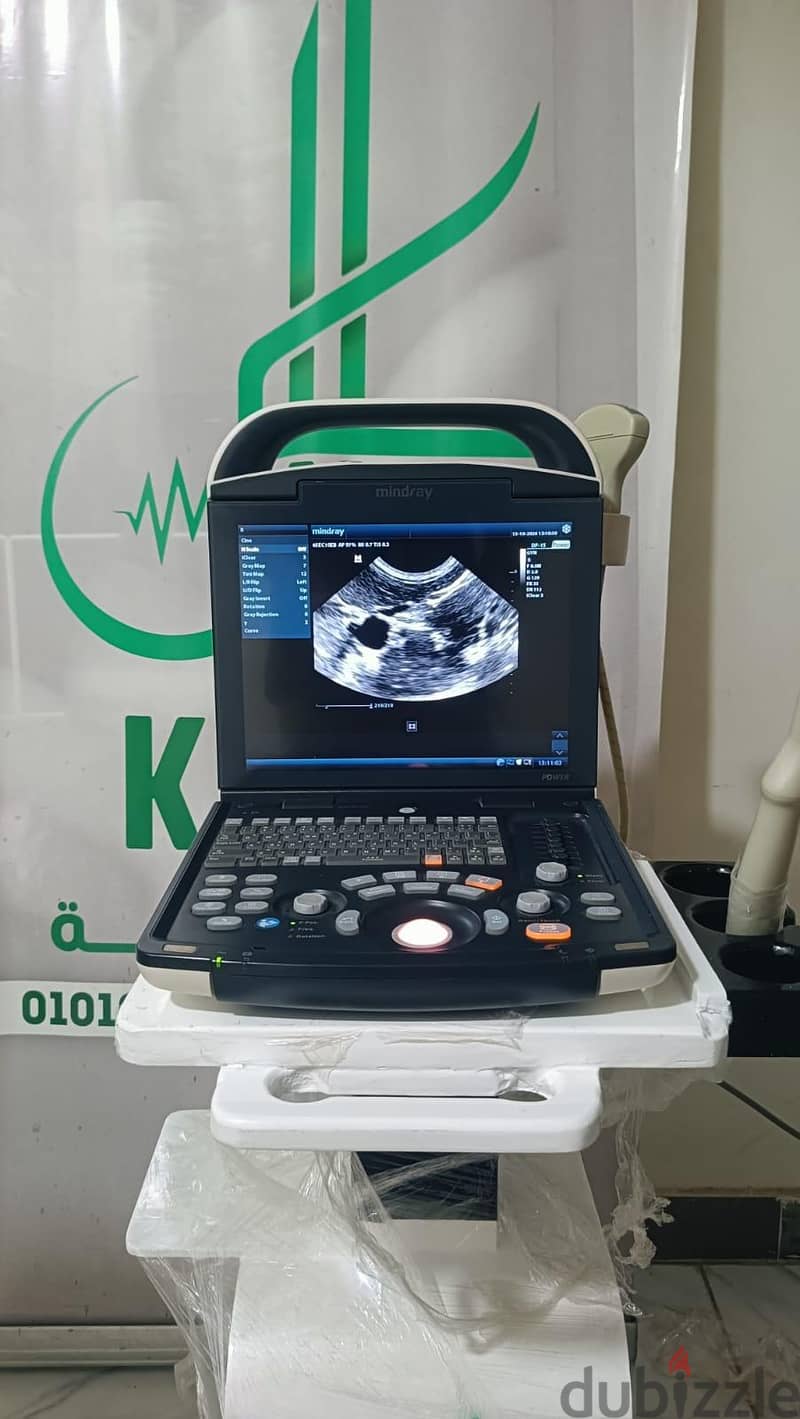 Mindray dp15 1