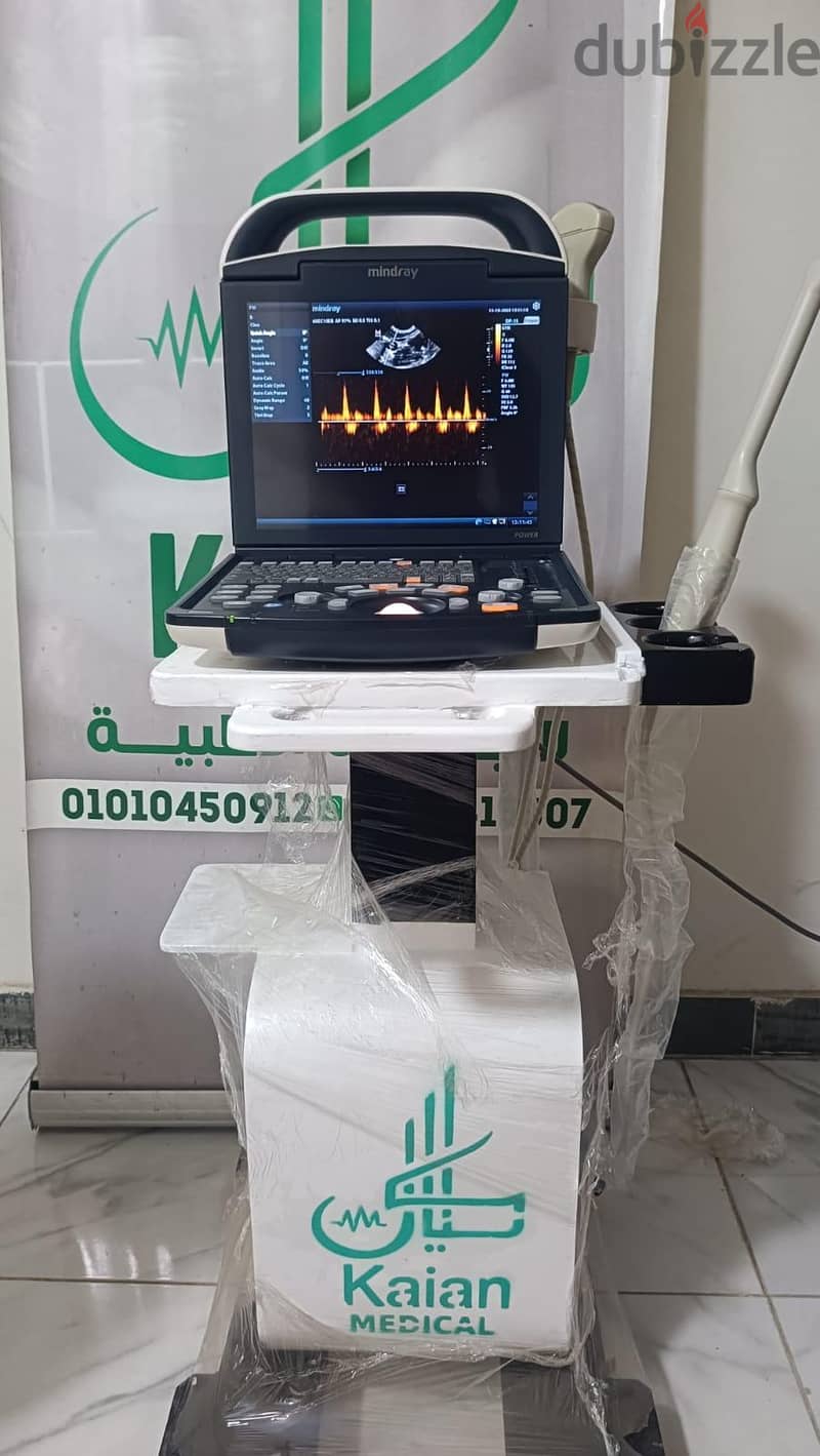Mindray dp15 2
