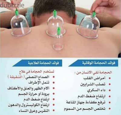 العلاج بالحجامة