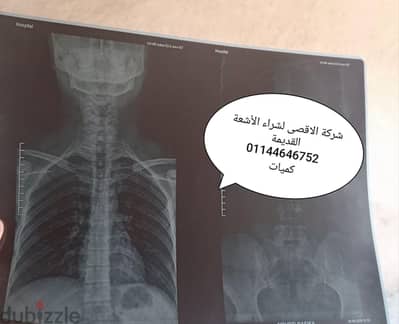 شركة الاقصى لشراء الأشعة القديمة