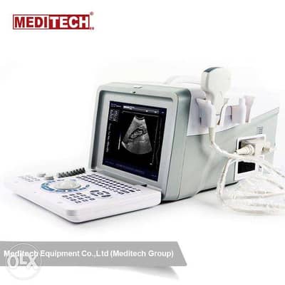 جهاز سونار (ultrasound)