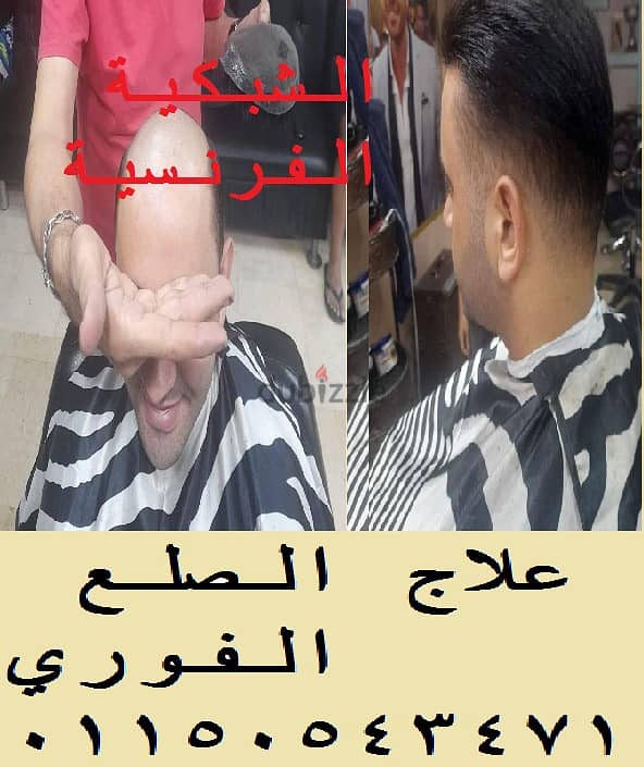 الشبكية الفرنسية للقضاء علي الصلع الوراثي هنرجع للرجل المصري وسامتة ! 4