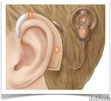 صيانة واصلاح أجهزة وسماعات قوقعة الأذن لضعاف السمع 4