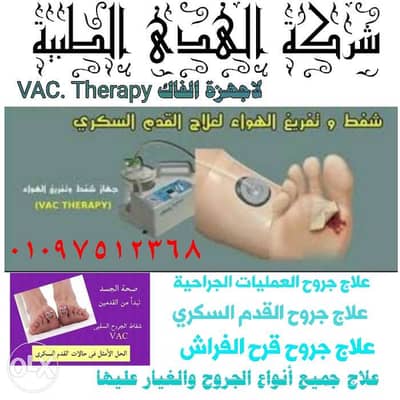 اجهزة شفط الجروح والقدم السكري ومستلزماتها