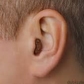 بطاريات سماعات الاذن الطبية لضعاف ضعاف السمع 10