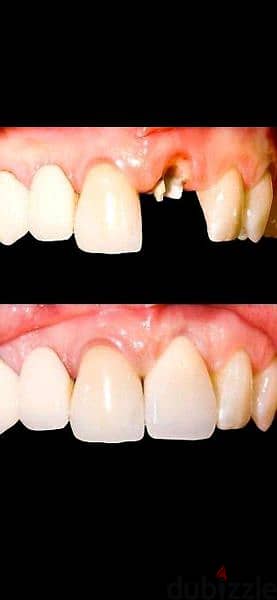معمل اسنان لتركيبات ثابتة ومتحركة والبورسلين 0