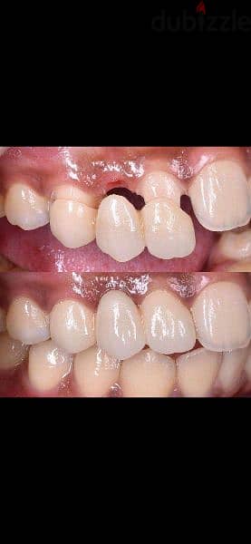 معمل اسنان لتركيبات ثابتة ومتحركة والبورسلين 1