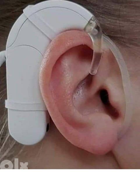 صيانة واصلاح أجهزة وسماعات قوقعة الأذن لضعاف السمع 8