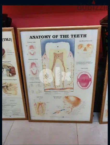٥ لوحات تعليميه طب الأسنان 5