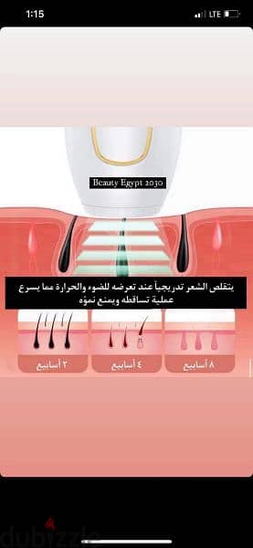 جهاز إزالة الشعر بالليزر IPL hair removal instrument 1