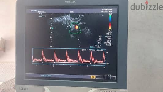 سونار توشيبا . . . . Toshiba Ultrasound for sale