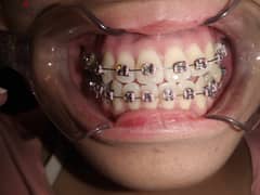 مطلوب شركة معدات (اسنان) طبية للبيع مع الترخيص 0