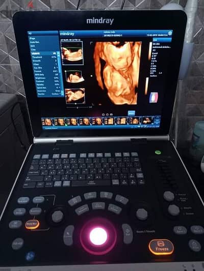 mindray z50