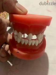 ‏عبارة عن طقم أسنان لكلية تبقى أسنان